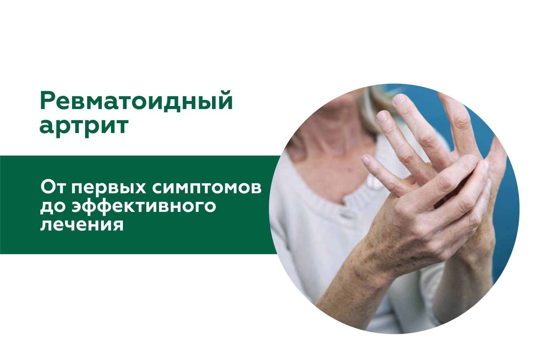 Иллюстрация к статье "Ревматоидный артрит: что нужно знать пациенту"
