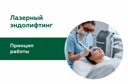 Иллюстрация к статье "Что такое лазерный эндолифтинг, какие бывают виды и как работает процедура"